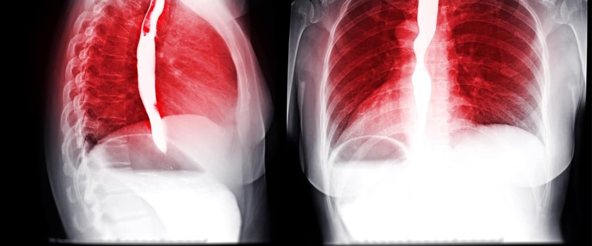 What Tests Can Help Diagnose Constipation?